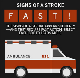 Stroke - FAST